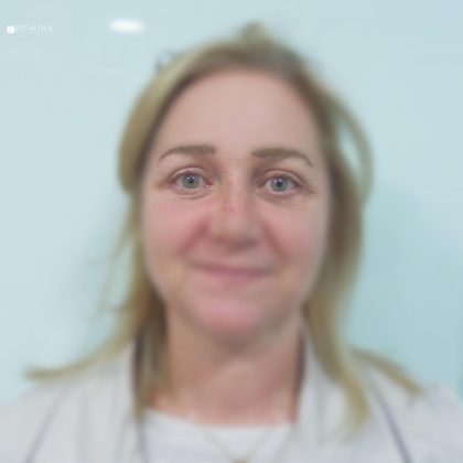 Blepharoplasty Before & After Patient #2979