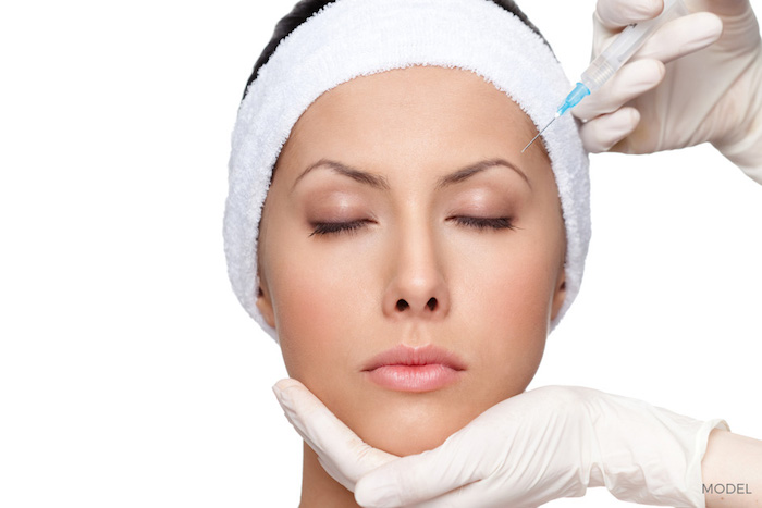 botox injections san diego
